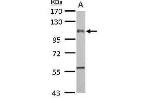 WB Image EMR1 antibody [C2C3], C-term detects EMR1 protein by Western blot analysis.