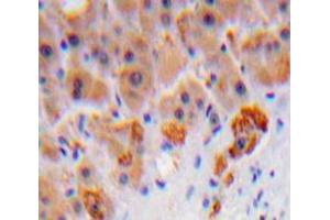 IHC-P analysis of Liver tissue, with DAB staining. (C8B anticorps  (AA 162-504))