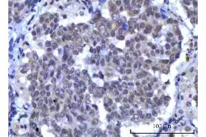 IHC analysis of RBM15B using anti-RBM15B antibody (ABIN7600219). (RBM15B anticorps  (AA 164-890))