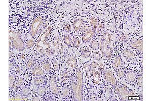Formalin-fixed and paraffin embedded human stomach tissue labeled with Anti-MACC1Polyclonal Antibody, Unconjugated (ABIN706526) followed by conjugation to the secondary antibody and DAB staining (MACC1 anticorps  (AA 761-852))
