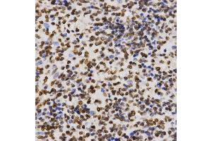 Immunohistochemistry of paraffin-embedded human kidney tissue using H3K27me2 antibody at dilution of 1:200 (x400 lens).