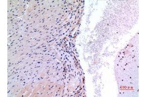 Immunohistochemistry (IHC) analysis of paraffin-embedded Mouse Heart, antibody was diluted at 1:100. (VEGFC anticorps  (Internal Region))