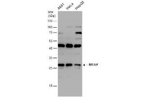 WB Image MTAP antibody detects MTAP protein by western blot analysis. (MTAP anticorps)