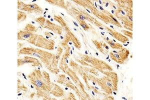 IHC analysis of FFPE human heart section using SMAD1 antibody; Ab was diluted at 1:25.