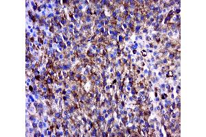 Paraformaldehyde-fixed, paraffin embedded human melanoma , Antigen retrieval by boiling in sodium citrate buffer (pH6.