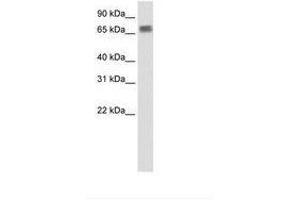 Image no. 1 for anti-Zinc Finger Protein 64 (ZFP64) (N-Term) antibody (ABIN203231) (ZFP64 anticorps  (N-Term))