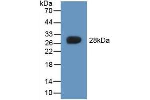 Detection of Recombinant CYGB, Rat using Polyclonal Antibody to Cytoglobin (CYGB)