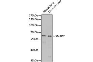 Western blot analysis of extracts of various cell lines, using SMAD2 antibody (ABIN4905224) at 1:1000 dilution. (SMAD2 anticorps)