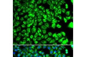 Immunofluorescence analysis of MCF-7 cells using C10orf32 Polyclonal Antibody (C10ORF32 anticorps)