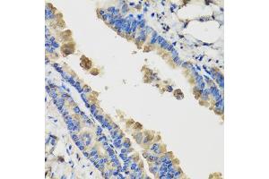 Immunohistochemistry of paraffin-embedded mouse lung using IL36G antibody (ABIN5974550) at dilution of 1/100 (40x lens). (IL1F9 anticorps)