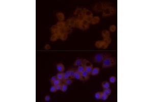 Immunofluorescence analysis of HepG2 cells using DTYMK Rabbit mAb (ABIN7266735) at dilution of 1:25 (40x lens). (DTYMK anticorps)