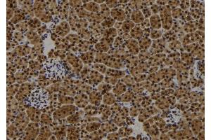 ABIN6272866 at 1/100 staining Mouse kidney tissue by IHC-P. (FIP200 anticorps)