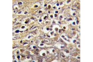 IHC analysis of FFPE human placenta tissue stained with Aromatase antibody