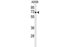 Western blot analysis of ATP6V1A Antibody (Center) in A2058 cell line lysates (35µg/lane). (ATP6V1A anticorps  (Middle Region))