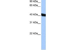 WB Suggested Anti-CHI3L1 Antibody Titration: 0. (CHI3L1 anticorps  (Middle Region))
