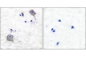 Immunohistochemistry analysis of paraffin-embedded human brain tissue, using Claudin 5 Antibody. (Claudin 5 anticorps  (AA 169-218))