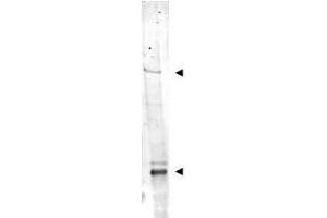 Western blot using  Affinity Purified anti-IDN3 antibody shows detection of bands at ~315 kDa and ~125 kDa corresponding to isoforms of IDN3 (arrow-heads) in mouse heart whole cell tissue extract. (NIPBL anticorps  (AA 344-356))