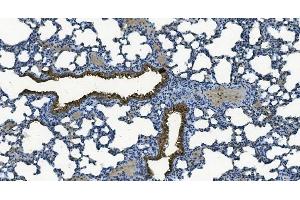 IHC analysis of MCU using anti-MCU antibody (ABIN7601931). (MCU anticorps  (AA 51-351))