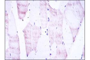 Immunohistochemical analysis of paraffin-embedded muscle tissues using OLIG2 mouse mAb with DAB staining.