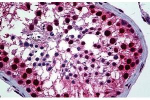 Human Testis: Formalin-Fixed, Paraffin-Embedded (FFPE)