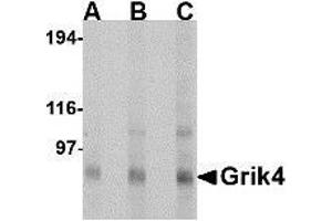 Western blot analysis of Grik4 in Rat brain tissue lysate with AP30385PU-N Grik4 antibody at (A) 0.