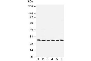 Western blot testing of ARC antibody and human samples 1:  SMMC-7721;  2: A549;  3: U87;  4: HeLa;  5: MCF-7;  6: rat liver