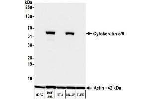 Western Blotting (WB) image for anti-Keratin 5/6 (KRT5/6) (C-Term) antibody (ABIN7795768)