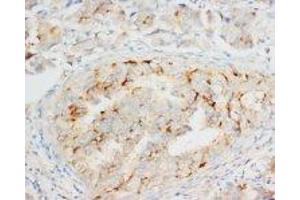 anti-Opioid Binding Protein/cell Adhesion Molecule-Like (OPCML) (C-Term) antibody