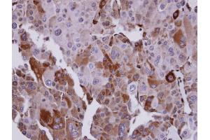 anti-Ubiquitin-Conjugating Enzyme E2T (Ube2t) (C-Term) antibody