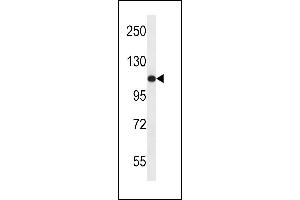 USO1 Antibody (C-term) (ABIN657956 and ABIN2846901) western blot analysis in ZR-75-1 cell line lysates (35 μg/lane). (USO1 anticorps  (C-Term))