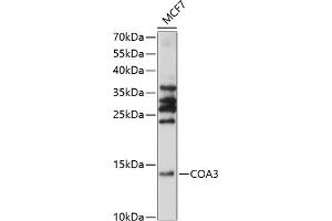 Western blot analysis of extracts of MCF7 cells, using CO antibody (ABIN7266633) at 1:1000 dilution. (CCDC56 anticorps  (AA 1-106))