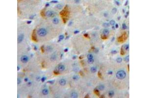 Used in DAB staining on fromalin fixed paraffin-embedded Liver tissue