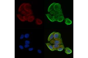ABIN6265620 and ABIN6278644 staining Hela cells(30 min of UV treatment) by IF/ICC. (TMPRSS3 anticorps  (Internal Region))
