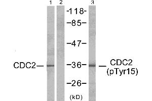 Western blot analysis of extracts from HepG2 cells, CDC2 (Ab-15) antibody (#Line 1 and 2) and CDC2 (phospho-Tyr15) antibody (Line 3). (CDK1 anticorps  (pTyr15))