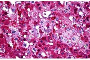 Human Adrenal: Formalin-Fixed, Paraffin-Embedded (FFPE)