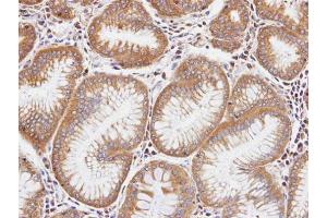 IHC-P Image Immunohistochemical analysis of paraffin-embedded human gastric tissue, using DIAPH1, antibody at 1:100 dilution. (DIAPH1 anticorps  (N-Term))