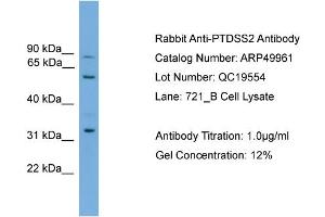 WB Suggested Anti-PTDSS2  Antibody Titration: 0. (PTDSS2 anticorps  (Middle Region))