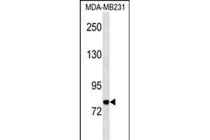 MFI2 Antibody (C-term) (ABIN1537509 and ABIN2850390) western blot analysis in MDA-M cell line lysates (35 μg/lane). (MFI2 anticorps  (C-Term))