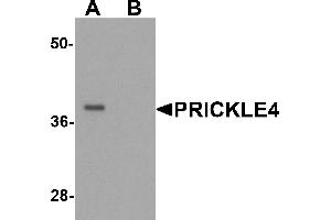 Western Blotting (WB) image for anti-Prickle Homolog 4 (PRICKLE4) (N-Term) antibody (ABIN1077371) (PRICKLE4 anticorps  (N-Term))