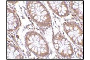 Immunohistochemistry of PTK7 in human colon tissue with this product at 2. (PTK7 anticorps  (C-Term))