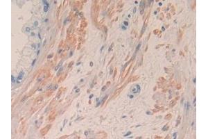 Detection of IL8 in Human Prostate Tissue using Monoclonal Antibody to Interleukin 8 (IL8) (IL-8 anticorps  (AA 28-99))