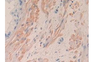 Detection of IL8 in Human Prostate Tissue using Monoclonal Antibody to Interleukin 8 (IL8)