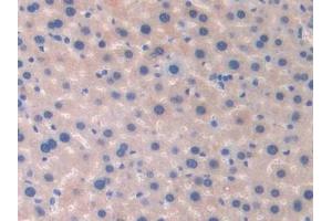 Detection of FBLN4 in Mouse Liver Tissue using Polyclonal Antibody to Fibulin 4 (FBLN4)