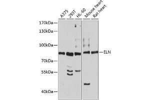 Western blot analysis of extracts of various cell lines, using ELN antibody (ABIN3016530, ABIN3016531, ABIN3016532 and ABIN6219774) at 1:1195 dilution. (Elastin anticorps  (AA 27-200))