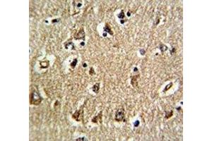 IHC analysis of FFPE human brain tissue stained with RAN antibody (RAN anticorps  (AA 12-39))