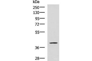 Western blot analysis of TM4 cell lysate using RAB3IL1 Polyclonal Antibody at dilution of 1:600 (RAB3IL1 anticorps)