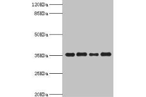 Western blot All lanes: PDXK antibody at 5. (PDXK anticorps  (AA 1-312))