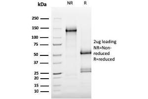 SDS-PAGE Analysis Purified MerTK Mouse Monoclonal Antibody (MERTK/3015). (MERTK anticorps  (AA 55-148))