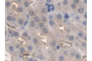 Detection of PNPO in Mouse Kidney Tissue using Polyclonal Antibody to Pyridoxamine-5'-Phosphate Oxidase (PNPO)
