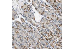 Immunohistochemical staining (Formalin-fixed paraffin-embedded sections) of human stomach using TAOK3 polyclonal antibody  shows strong cytoplasmic positivity in parietal cells. (TAO Kinase 3 anticorps  (AA 323-432))